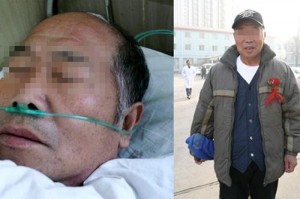 工地上出现脑梗谁的责任 