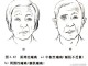 什么叫肌瘫 